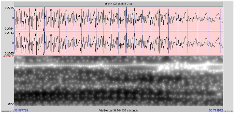 Spectrogram 3: "ar", by Ratinho